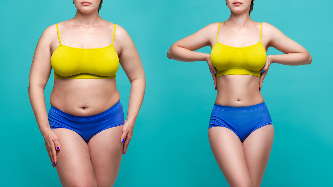 Understanding the Hourglass Tummy Tuck Procedure