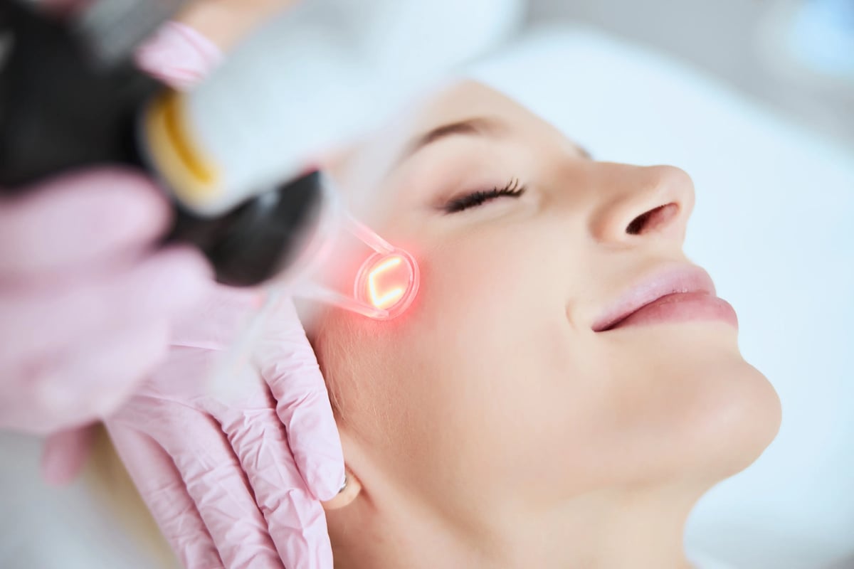 Illustrative stock photo of a woman receiving a facial laser treatment; not a Leva patient