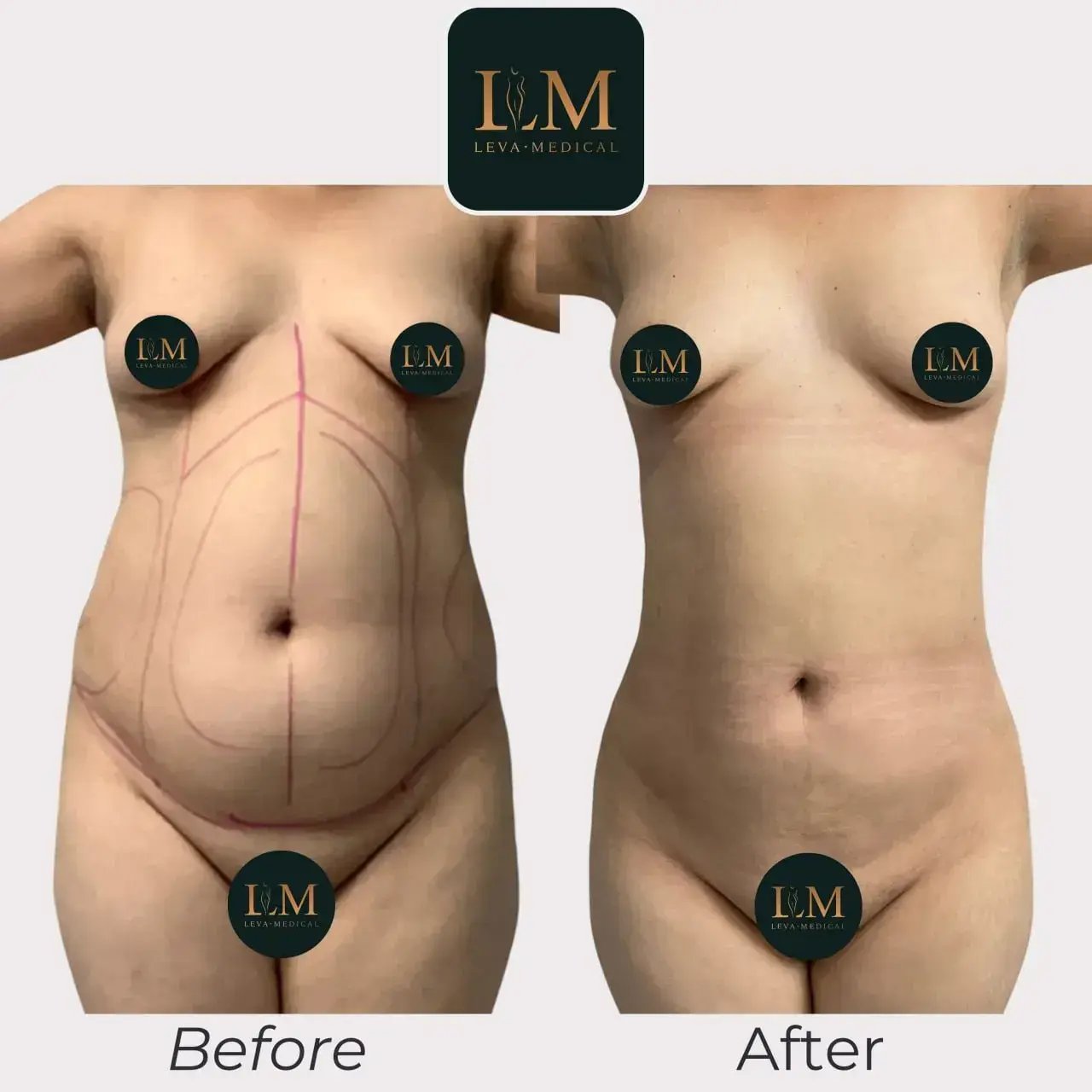 38dd019279391251d42ae406fab4019aef7c227c