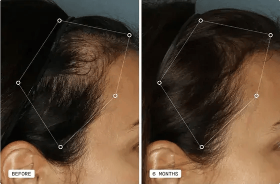 Hair & Scalp Restoration