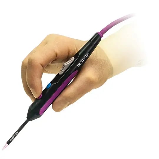 Illustrative image of the Renuvion radiofrequency and helium-plasma handpiece held in a gloved hand; does not show Leva patients