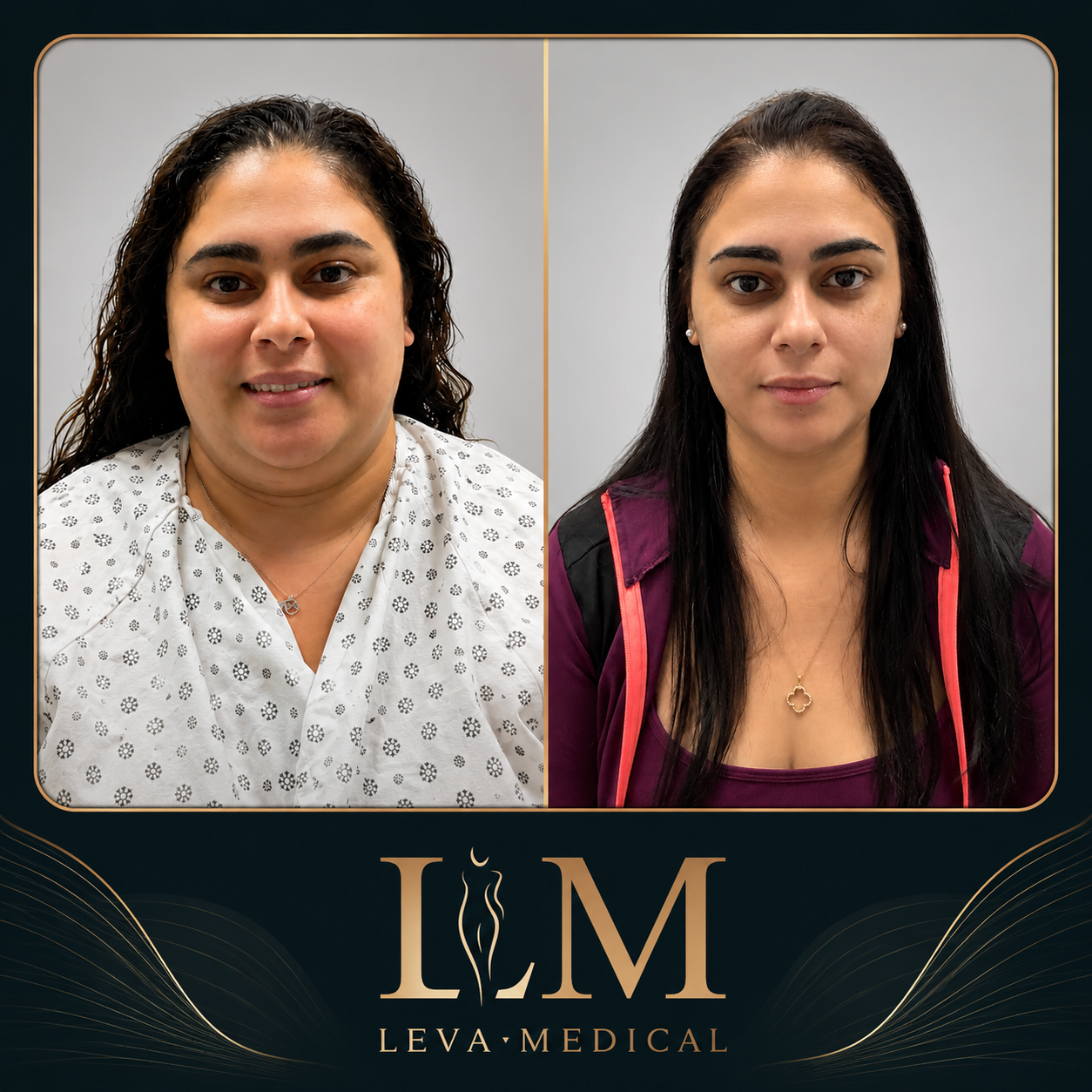 Weight Loss 2