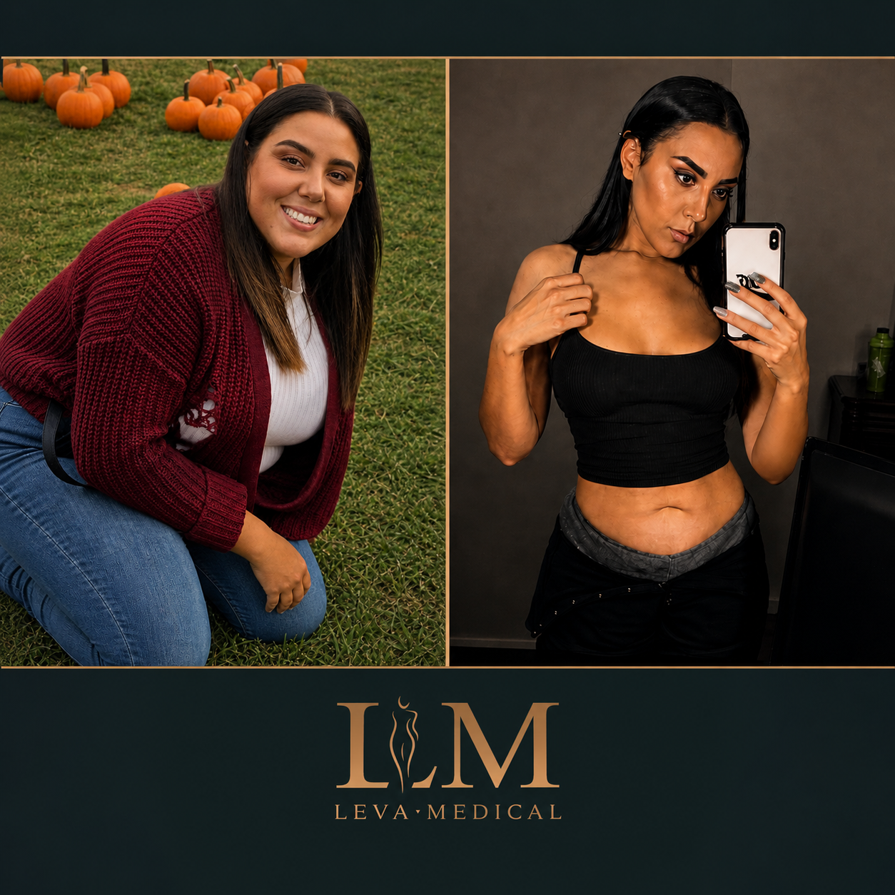 Weight Loss