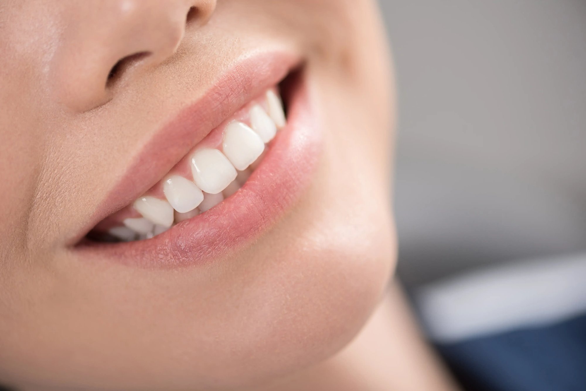 Illustrative stock close-up of a woman's smile and lower face; not a Leva patient