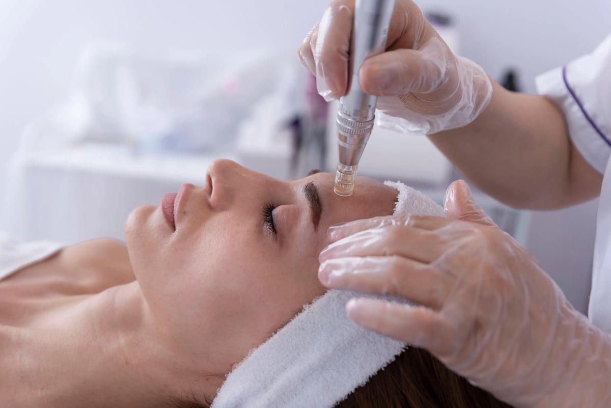 Illustrative stock photo of a woman receiving a microneedling pen treatment; not a Leva patient