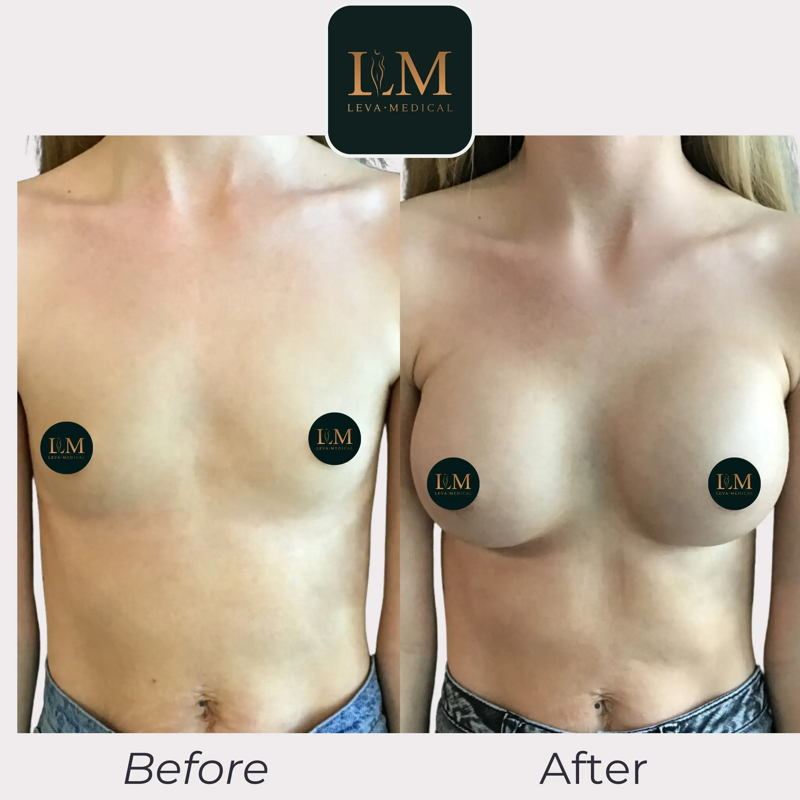 fc6fe9685a888afaf57382793c60d1b4c0839e60